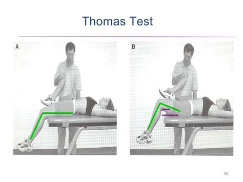 thomas test hamstring tear|hamstring tendonitis test positive.